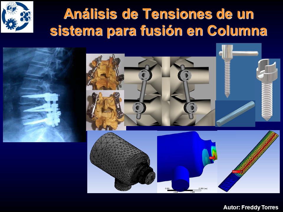 La cabeza como en la niebla a la osteocondrosis